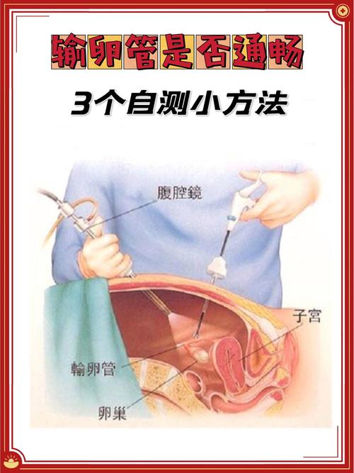 输卵管堵塞的检查方法