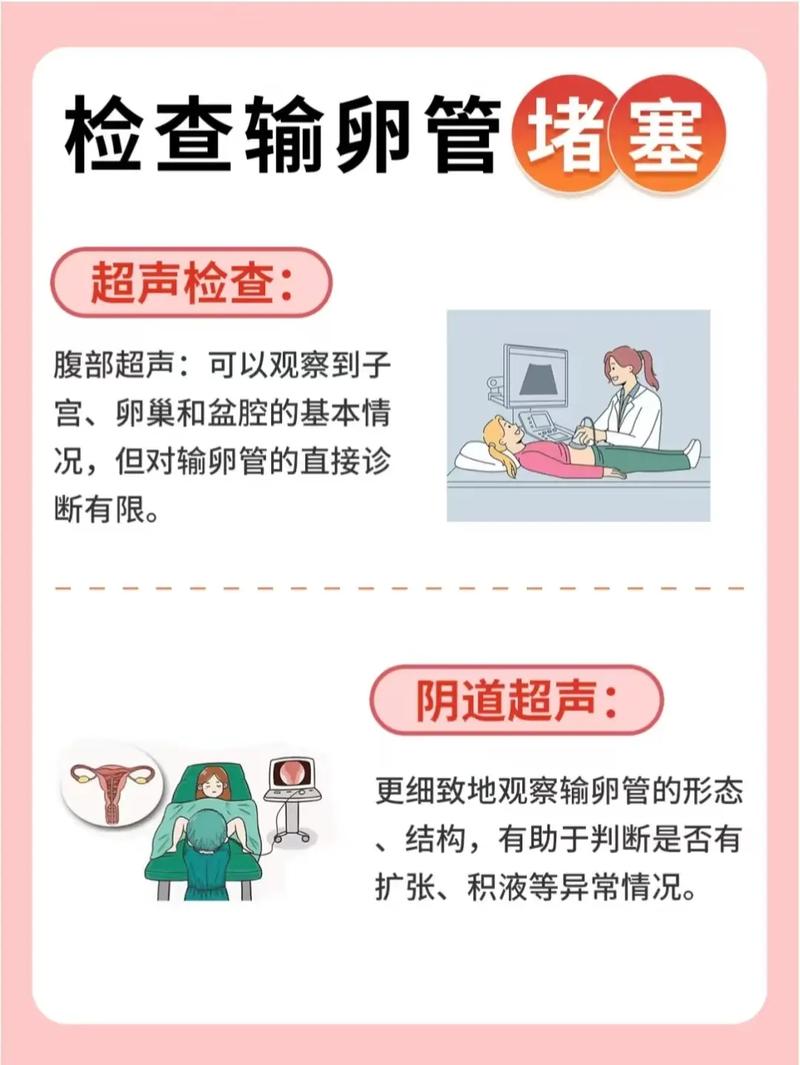 输卵管堵塞的检查方法