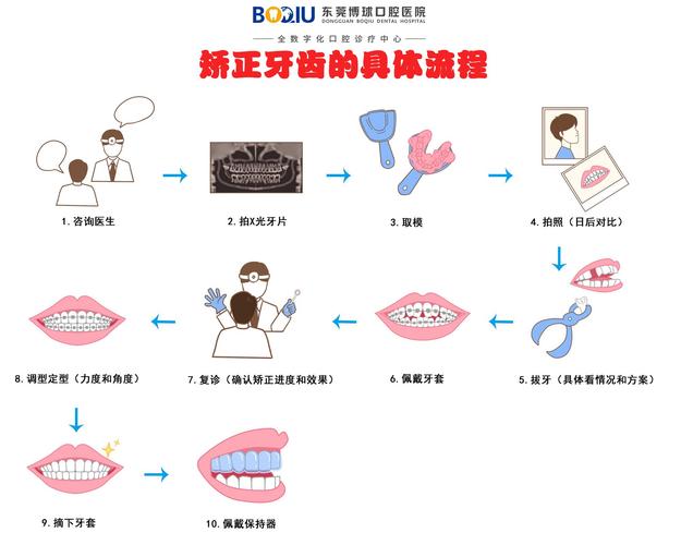 牙齿正畸步骤