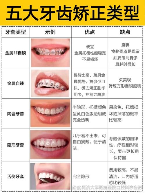 牙齿矫正的几种方法