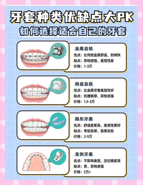 牙齿正畸步骤