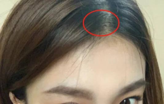 脸痣相图解大全女
