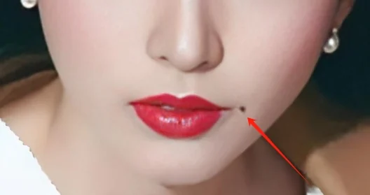 脸痣相图解大全女