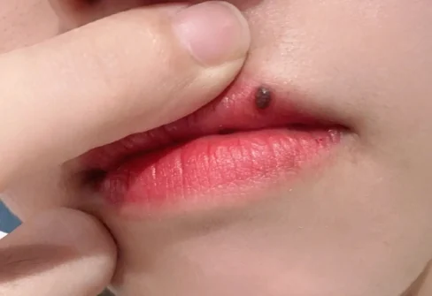 脸痣相图解大全女