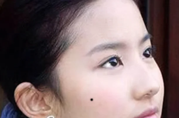脸痣相图解大全女