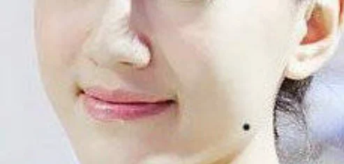 脸痣相图解大全女