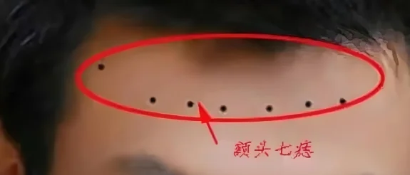 脸痣相图解大全女