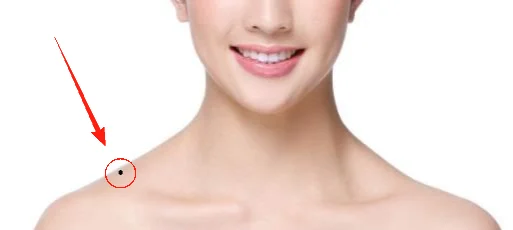 脸痣相图解大全女