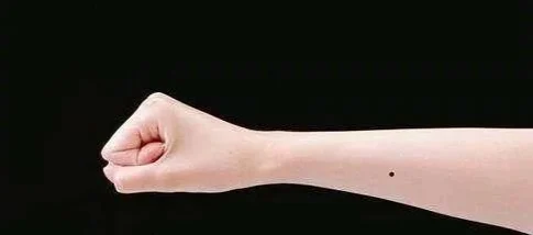 脸痣相图解大全女