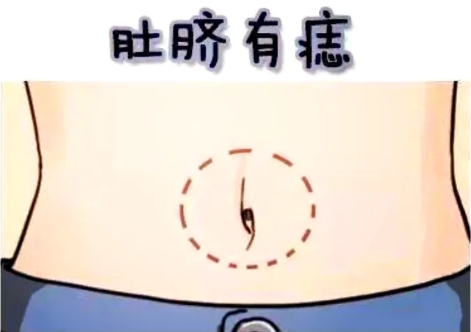 脸痣相图解大全女