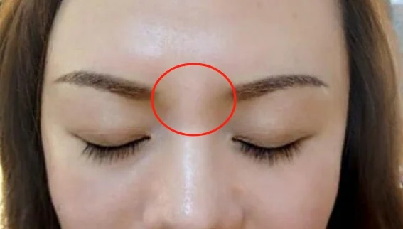 脸痣相图解大全女