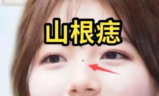 脸痣相图解大全女