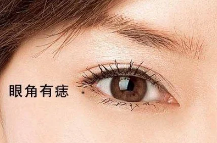 脸痣相图解大全女