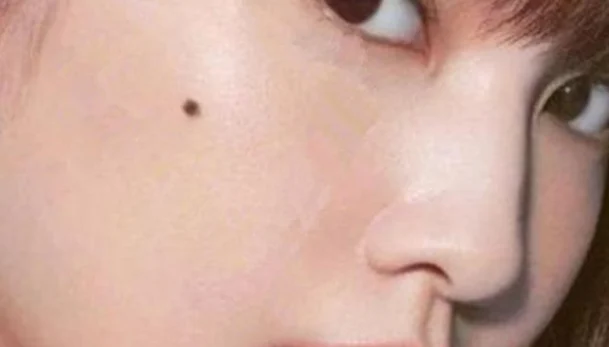 脸痣相图解大全女