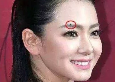 脸痣相图解大全女