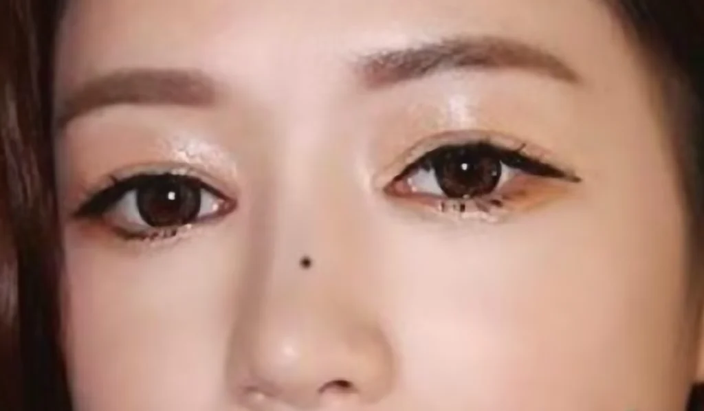 脸痣相图解大全女