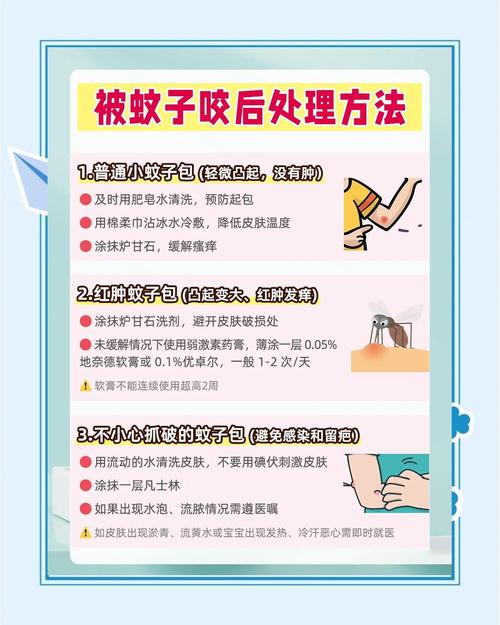 有什么方法驱蚊子?