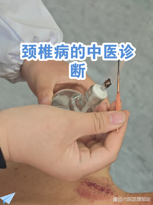 康骨堂 怎么判断是否患上颈椎病呢