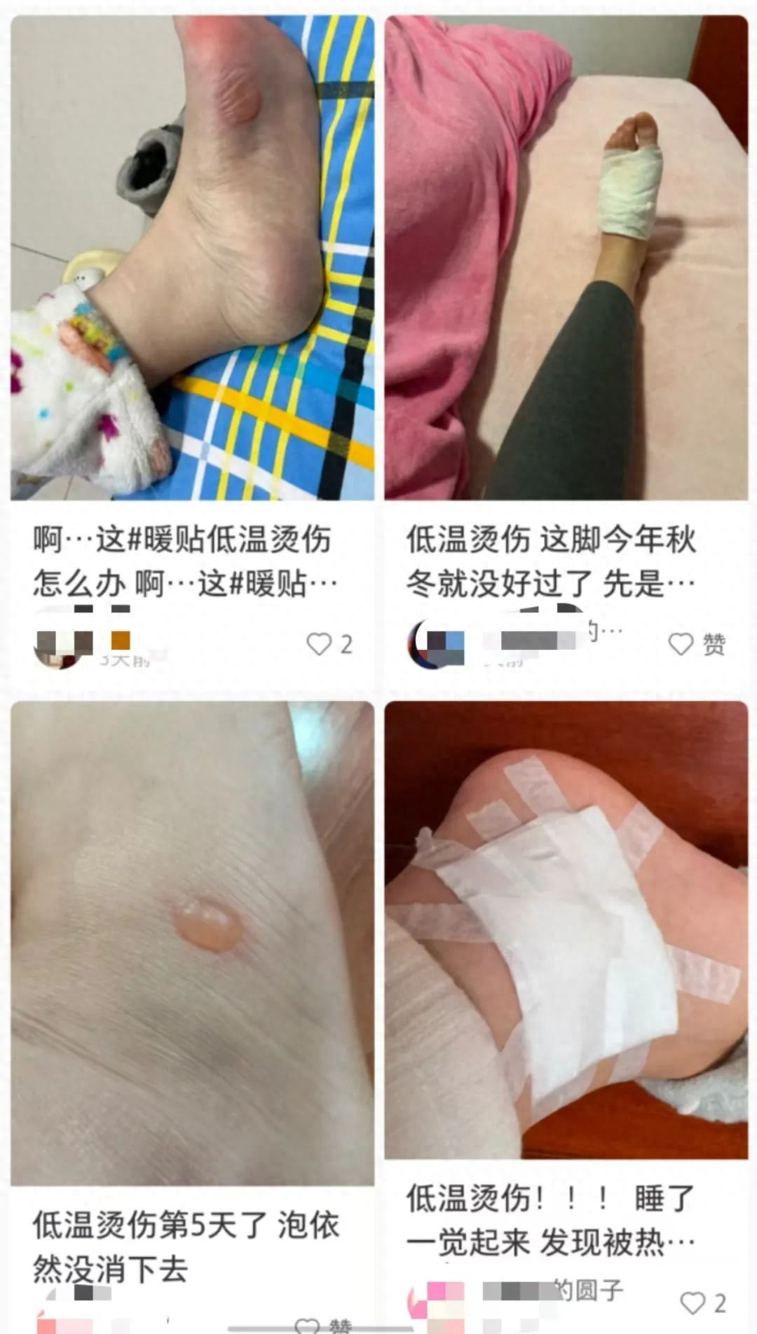 php datetime to date 一觉睡醒，身体突然出现水疱？！多是因为同床共枕的它 ……