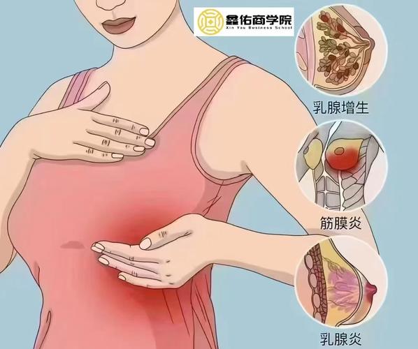 哺乳期乳腺炎怎么办